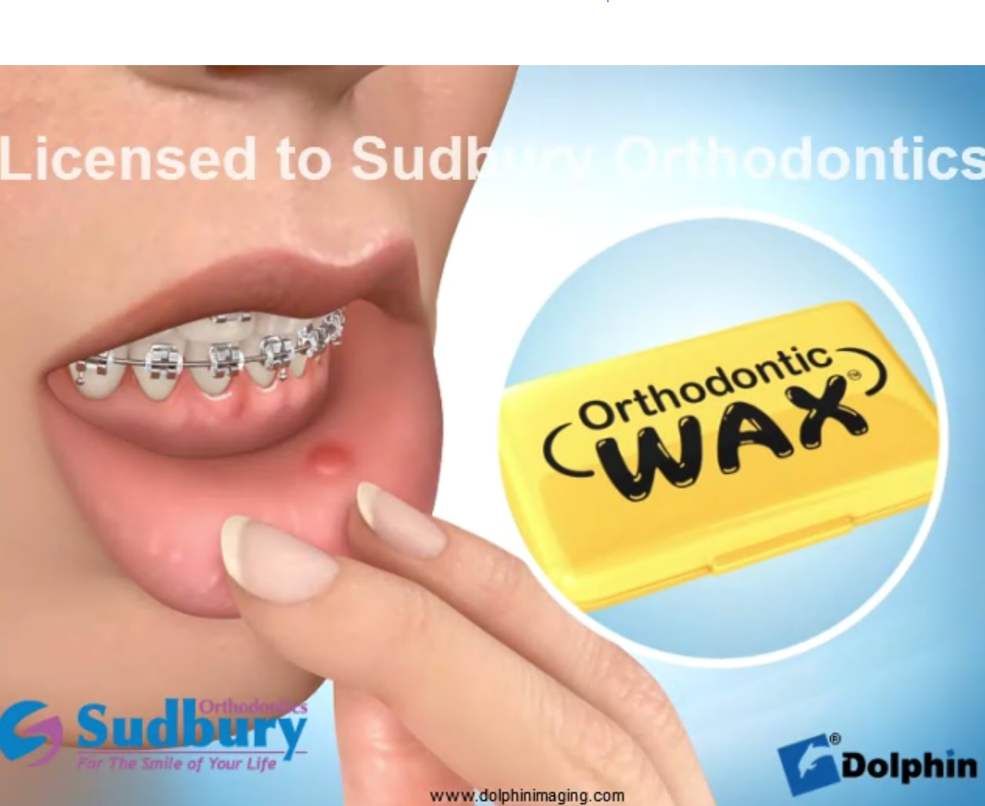 braces-manual – Sudbury Orthodontics